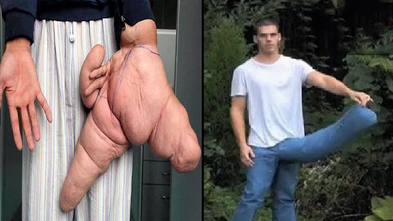 Worlds largest human sex organ, kenyan young virgin pussy pics
