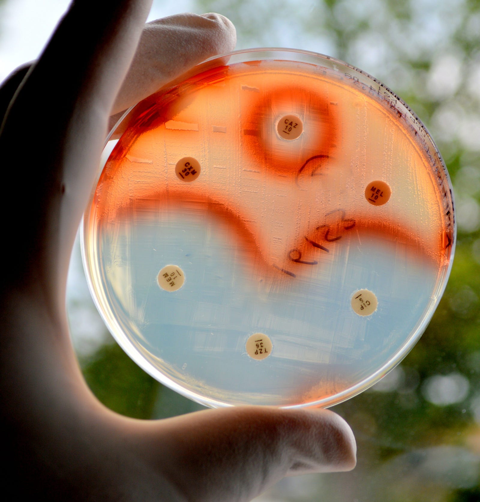Diagnostic Tests Can Help Prevent Antibiotic Resistance and Save Lives — If We Just Use Them