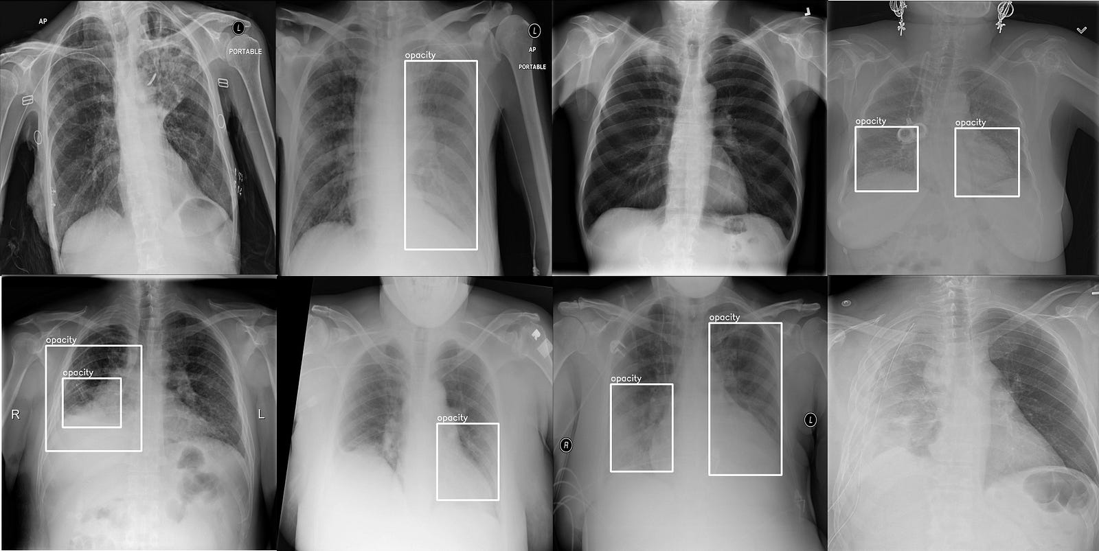 YOLO Object Detection Walkthrough for the RSNA Pneumonia Detection ...