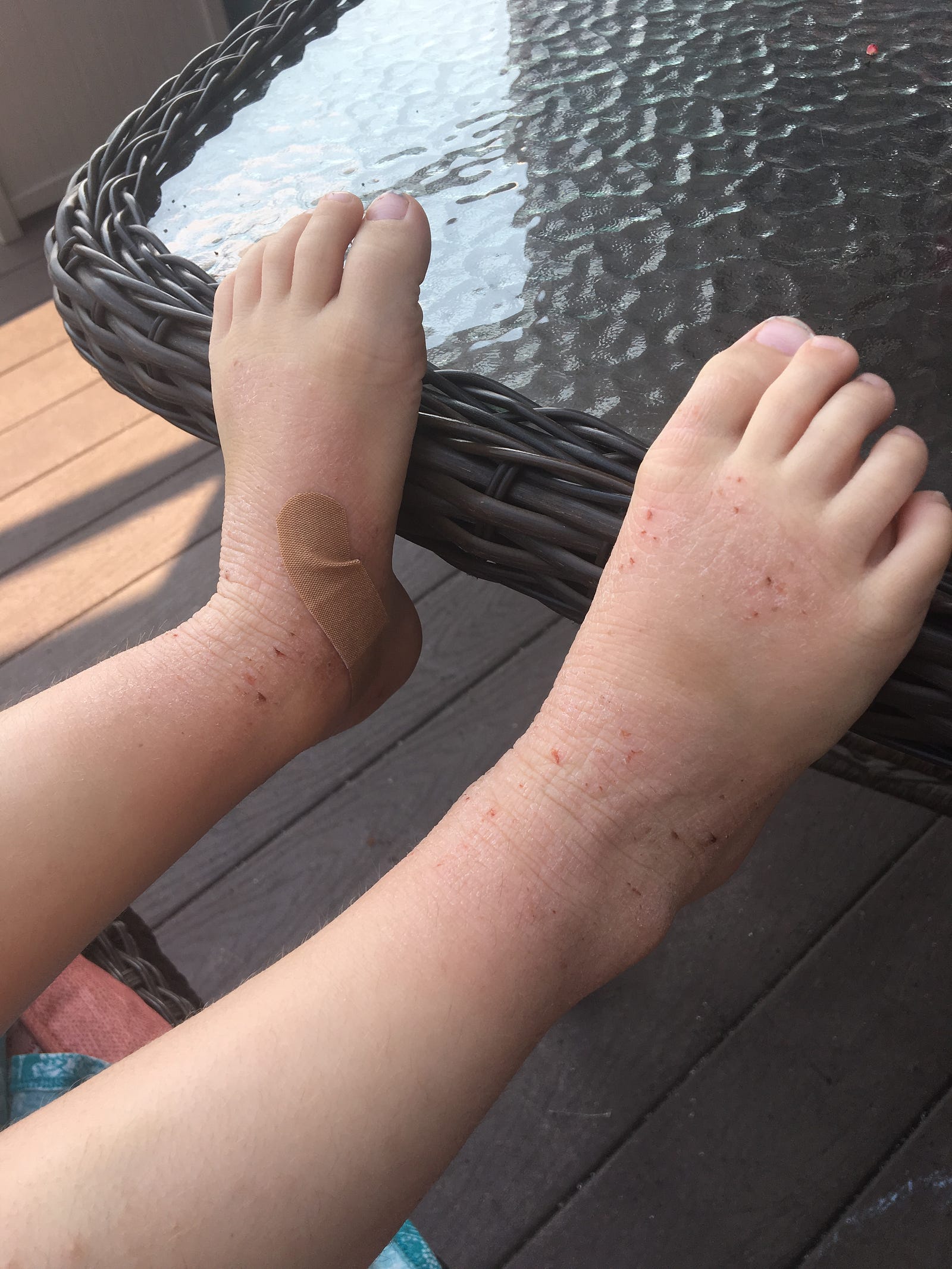 Bloody Sheets, Skin Flakes, and Never Ending Lotion