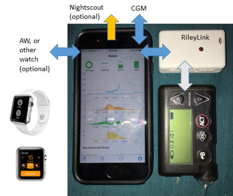 Closed Loop Insulin Pump Systems