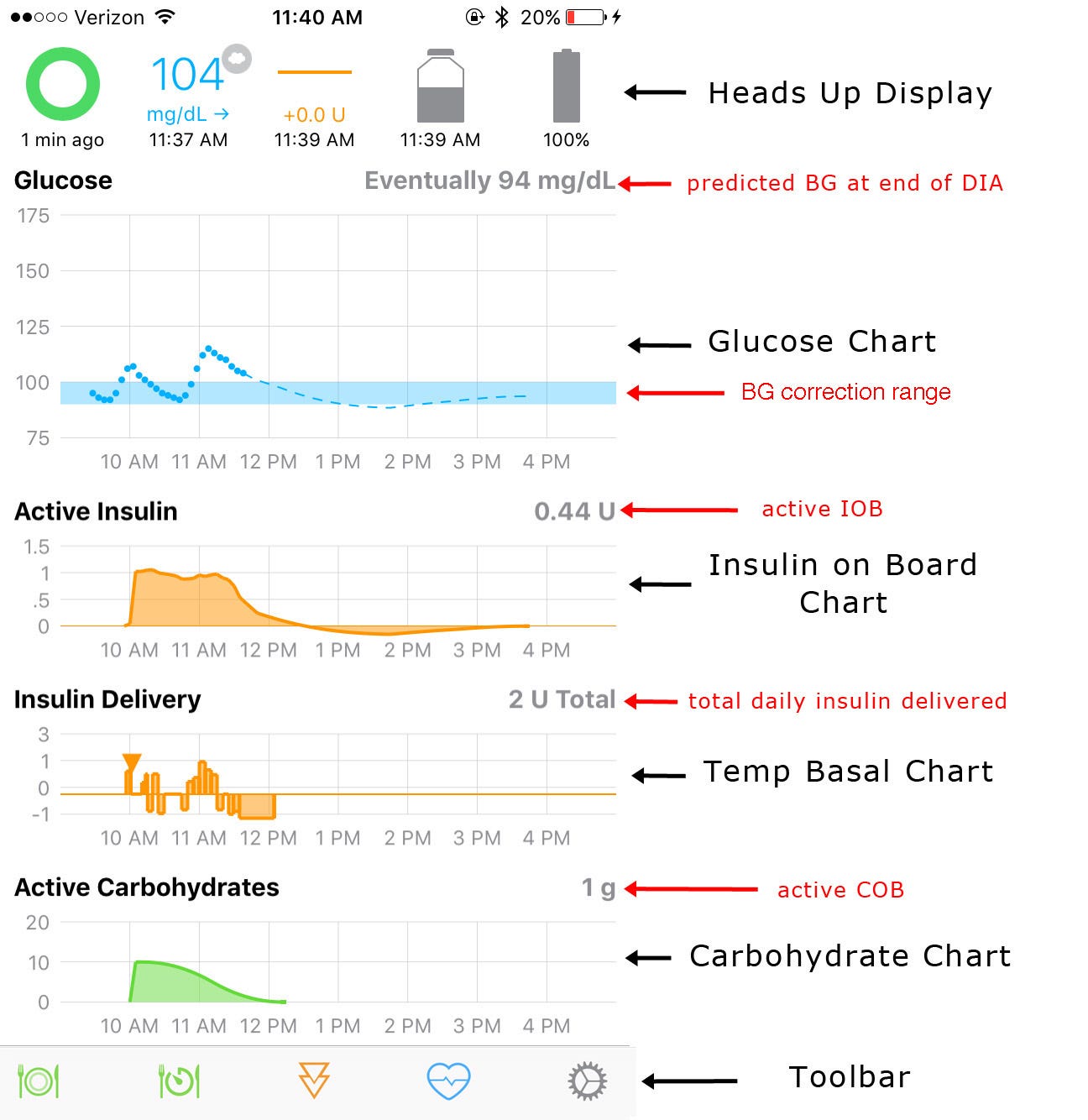 loop-a-diy-closed-loop-insulin-delivery-system-hackster-blog