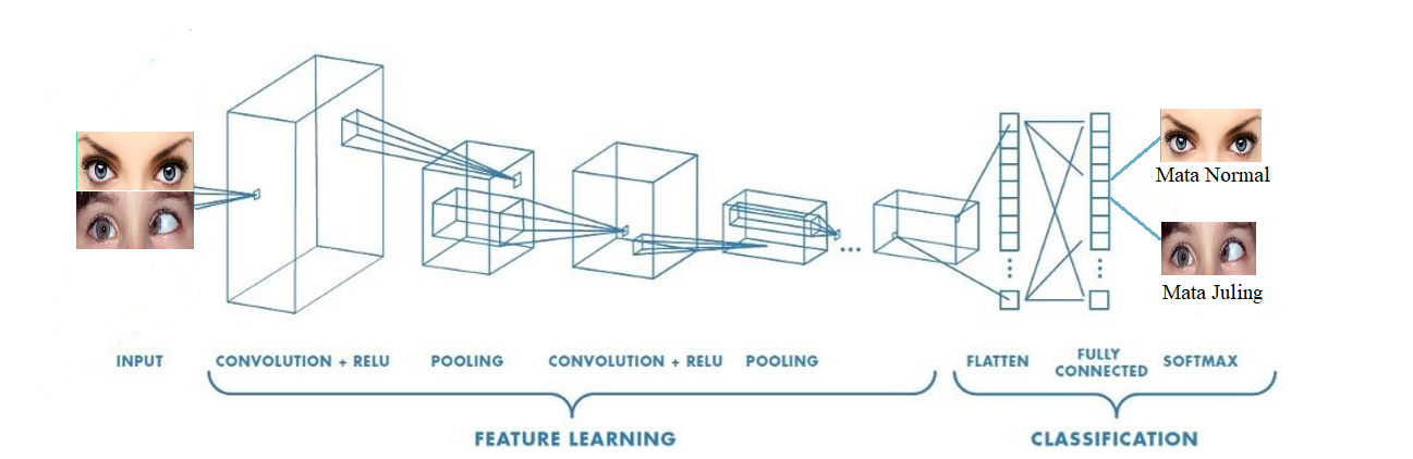 Implementasi Deep Learning Menggunakan Convolutional Neural Network Untuk Klasifikasi Gambar Mata