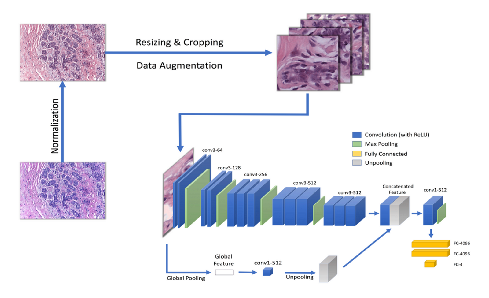breast cancer classification using machine learning research paper