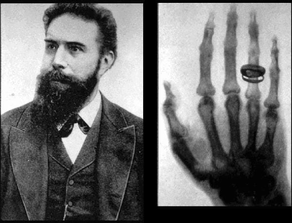 how-x-rays-were-discovered-by-mistake-ran-levi-medium