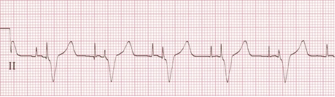 Pacemaker 101 – Tiffany Trinh – Medium