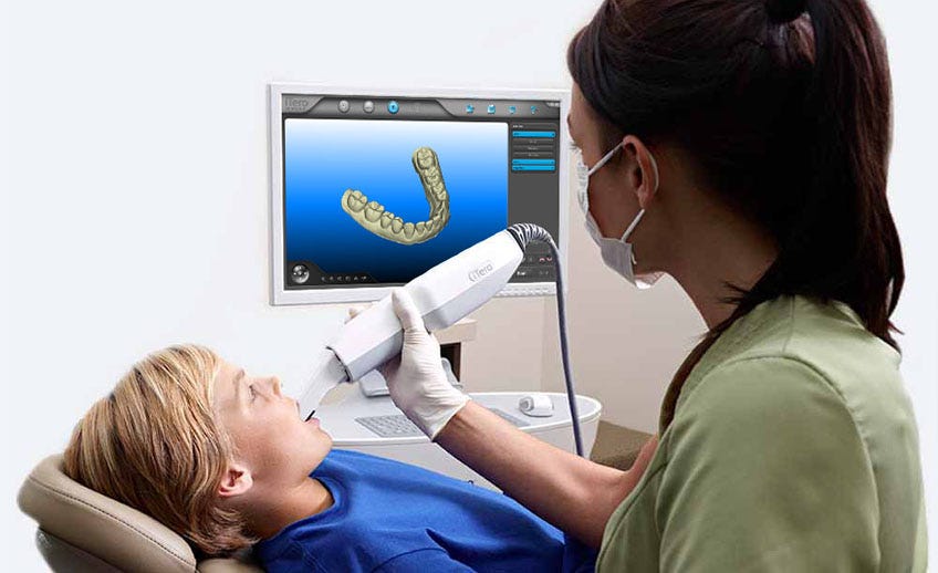 An amazing alternative to metal braces — Clear 3D printed teeth aligners
