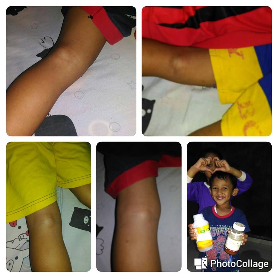 obat pencegah maag kambuh saat puasa pengobatan maag obat pencegah maag kambuh saat puasa pengobatan maag