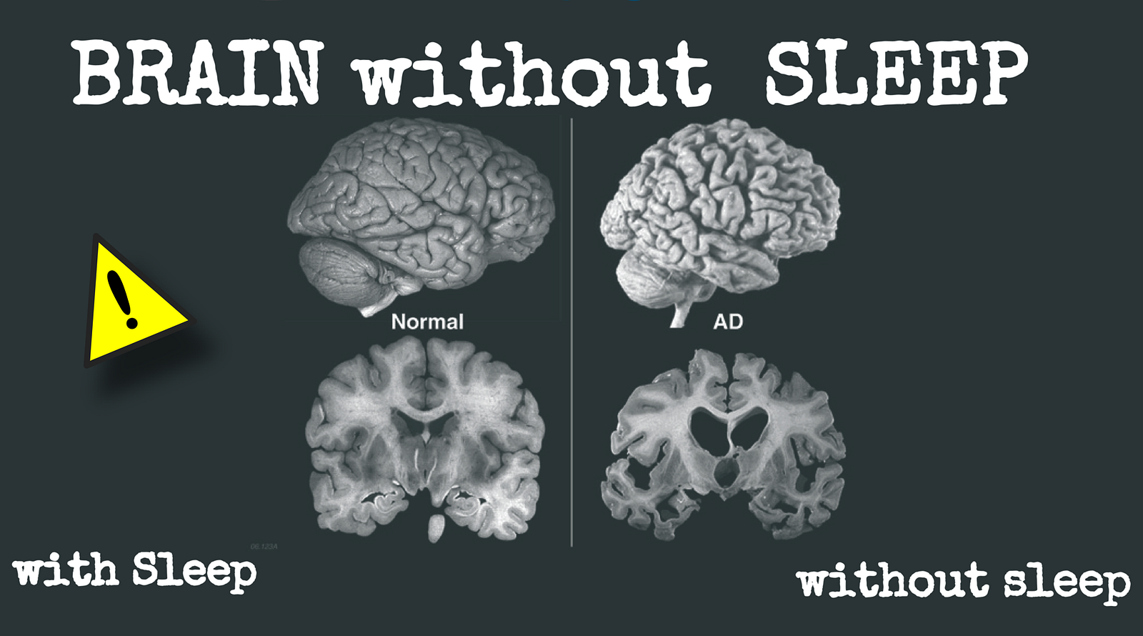 What will happen to your brain if you don’t sleep….