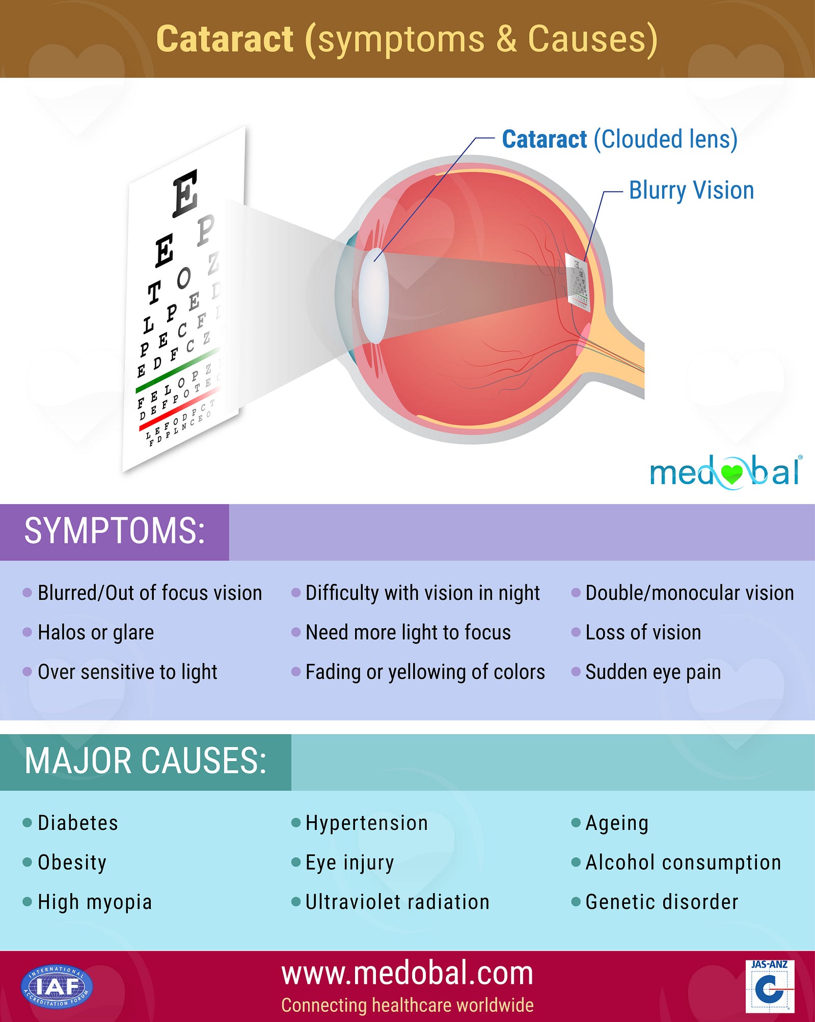 Cataracts Causes Symptoms And Treatment Sightsavers 