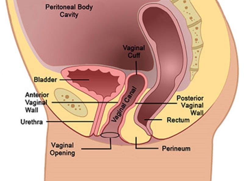 Nerve Damage To The Vaginal Cuff After Total Hysterectomy 