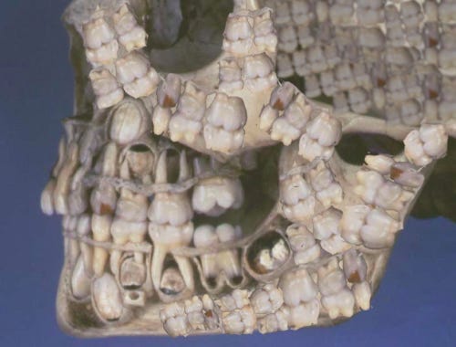 My Son's Skull Is 100% Teeth - Brian Firenzi - Medium