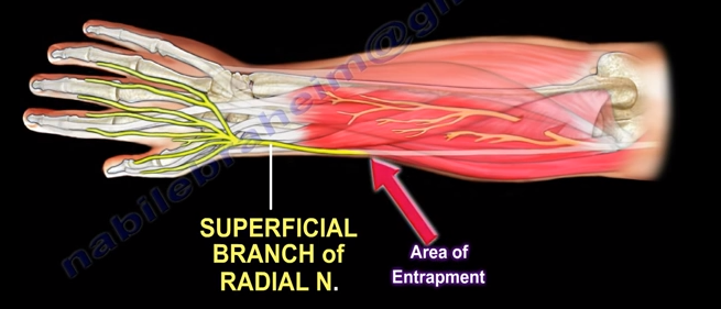 Wartenberg’s Syndrome – Nabil Ebraheim – Medium