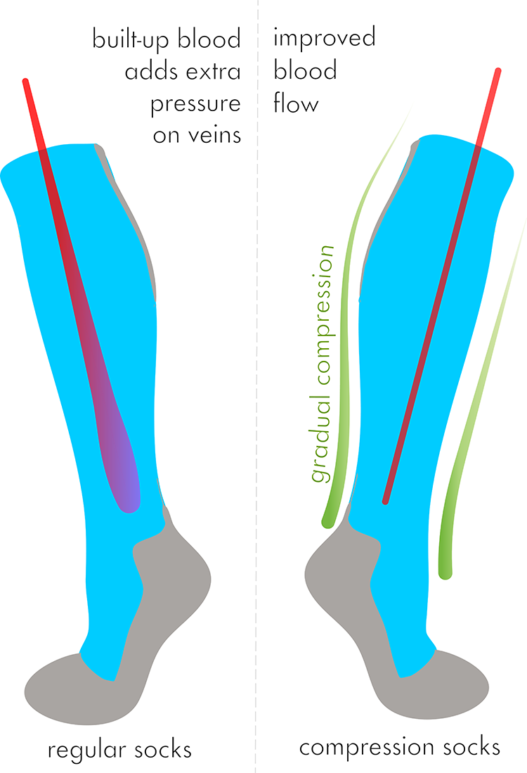 Compression socks vs regular socks a brief comparison
