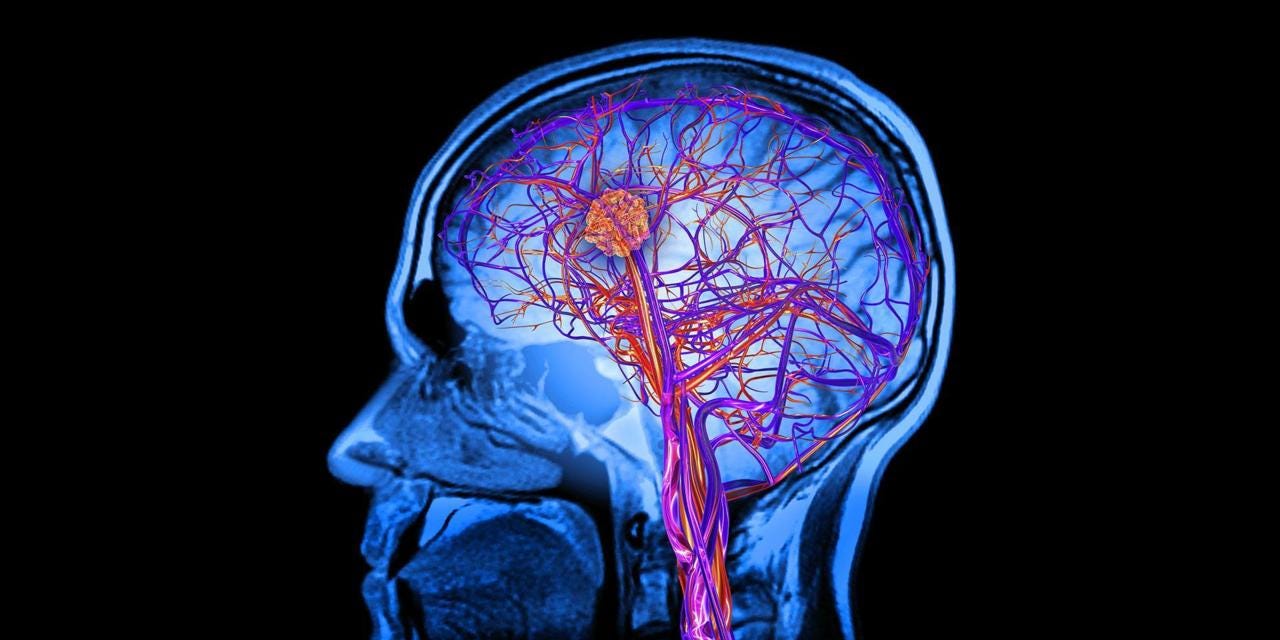 The Whole Brain Atlas, Harvard University - HMS The Whole Brain Atlas, Harvard University - HMS