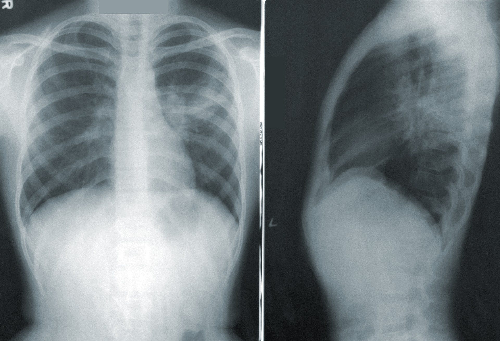 How to use fastai to evaluate DICOM medical files