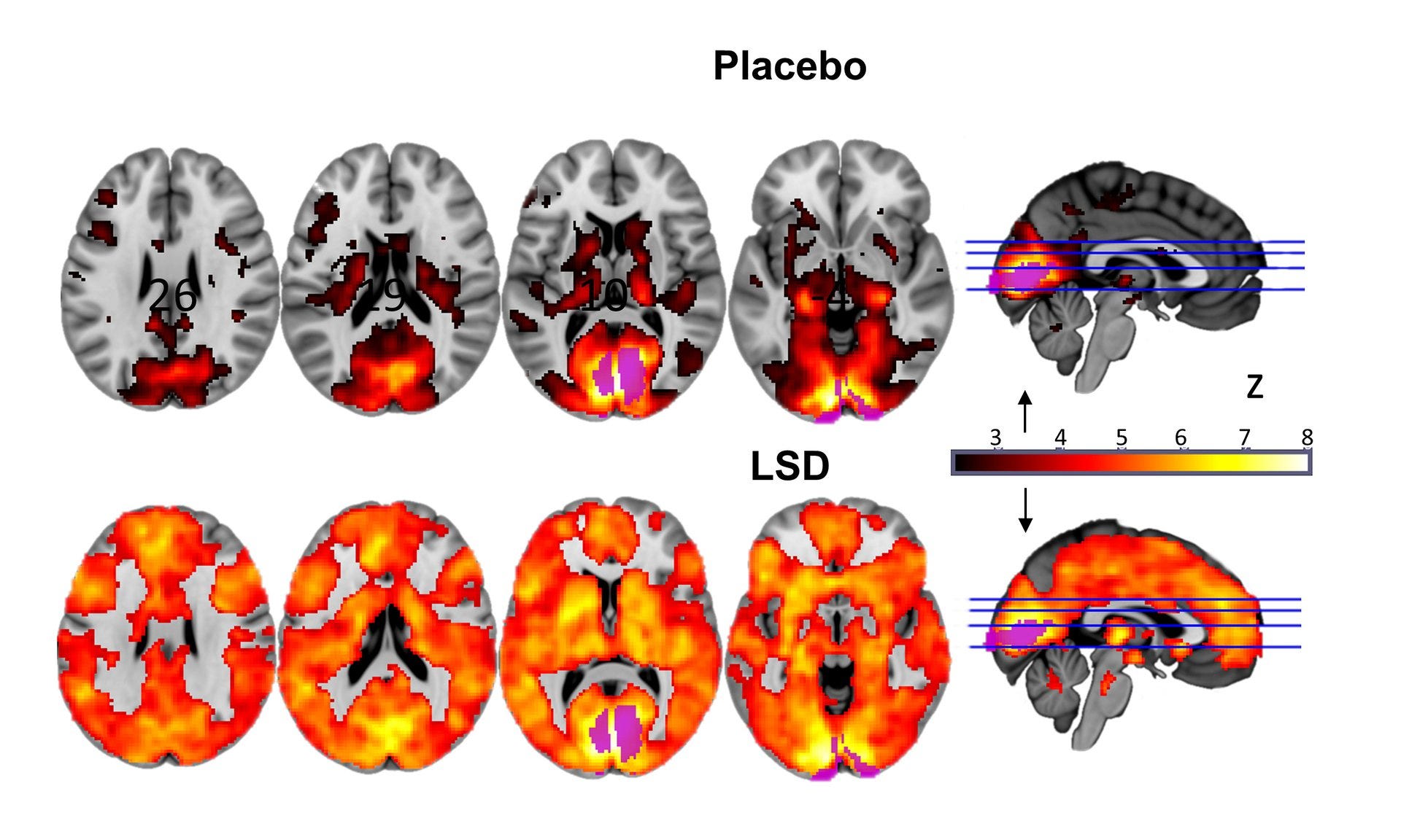 The times when all the LSD in the world were made by one person The times when all the LSD in the world were made by one person