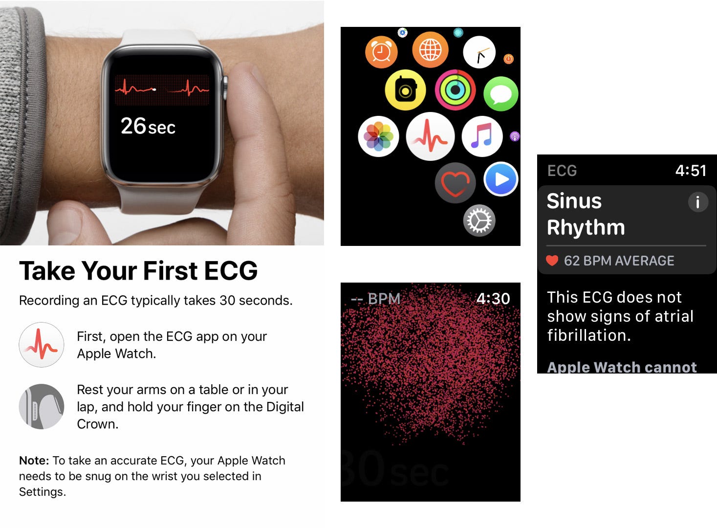 ecg app download apple watch
