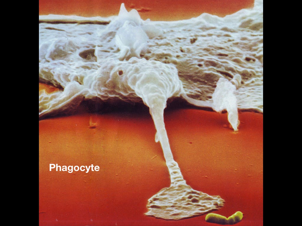 Фагоцит тянется ложноножкой к обреченной бактерии