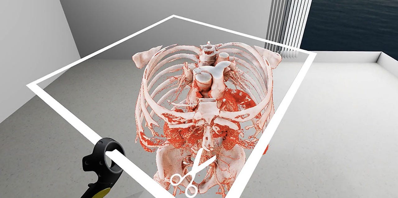 Surgeons use virtual reality simulations to prepare for their operations
