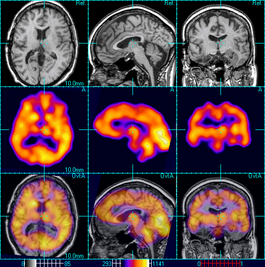 Images produced via Gamma Ray Imaging