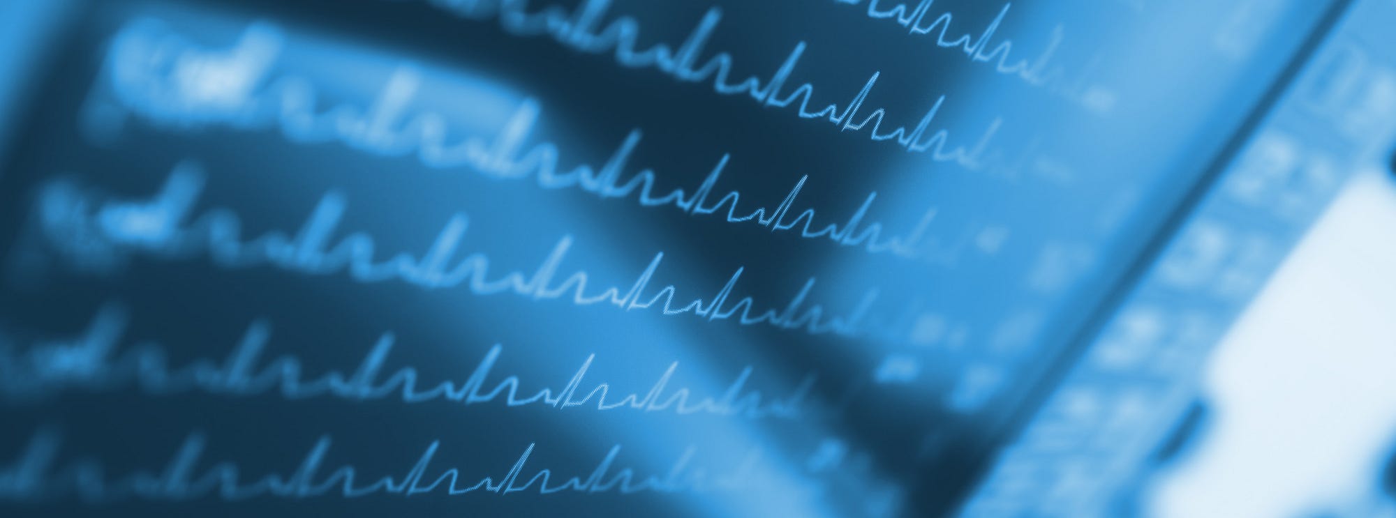 Forum on this topic: What Its Like to Join an Atrial , what-its-like-to-join-an-atrial/ Discussion on this topic: What Its Like to Join an Atrial , what-its-like-to-join-an-atrial/