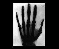 ONE OF THE EARLIEST X-RAY PHOTOGRAPHS, THIS ONE OF TESLA’S HAND