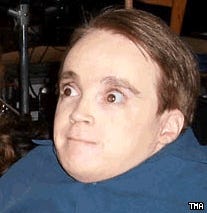 Eric The Midget