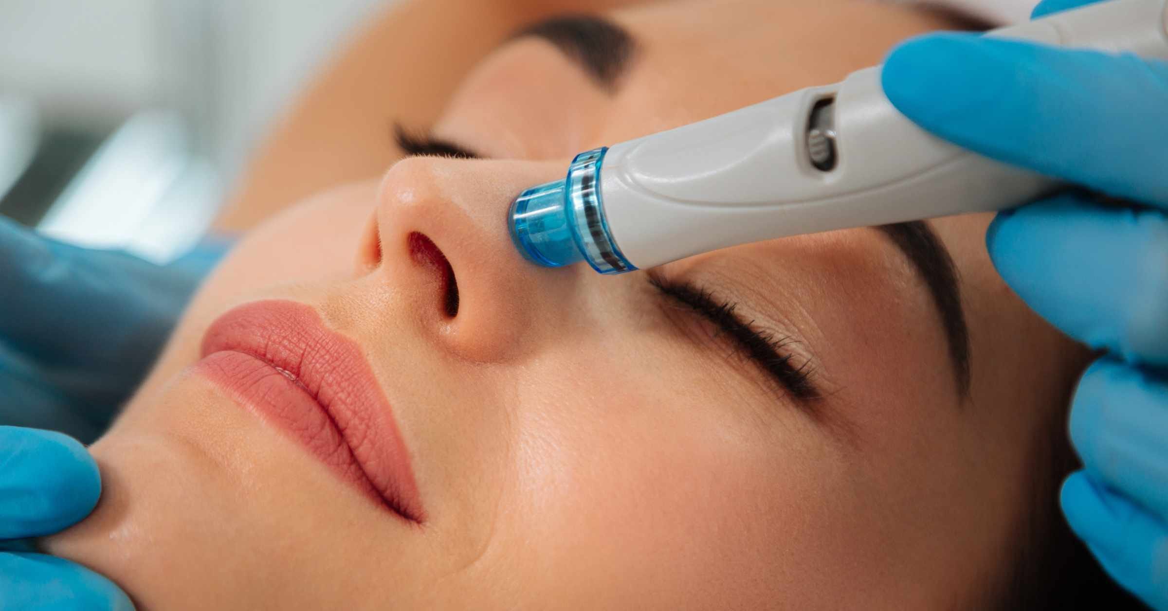 Can You Bring a Personal Microdermabrasion on a Plane-