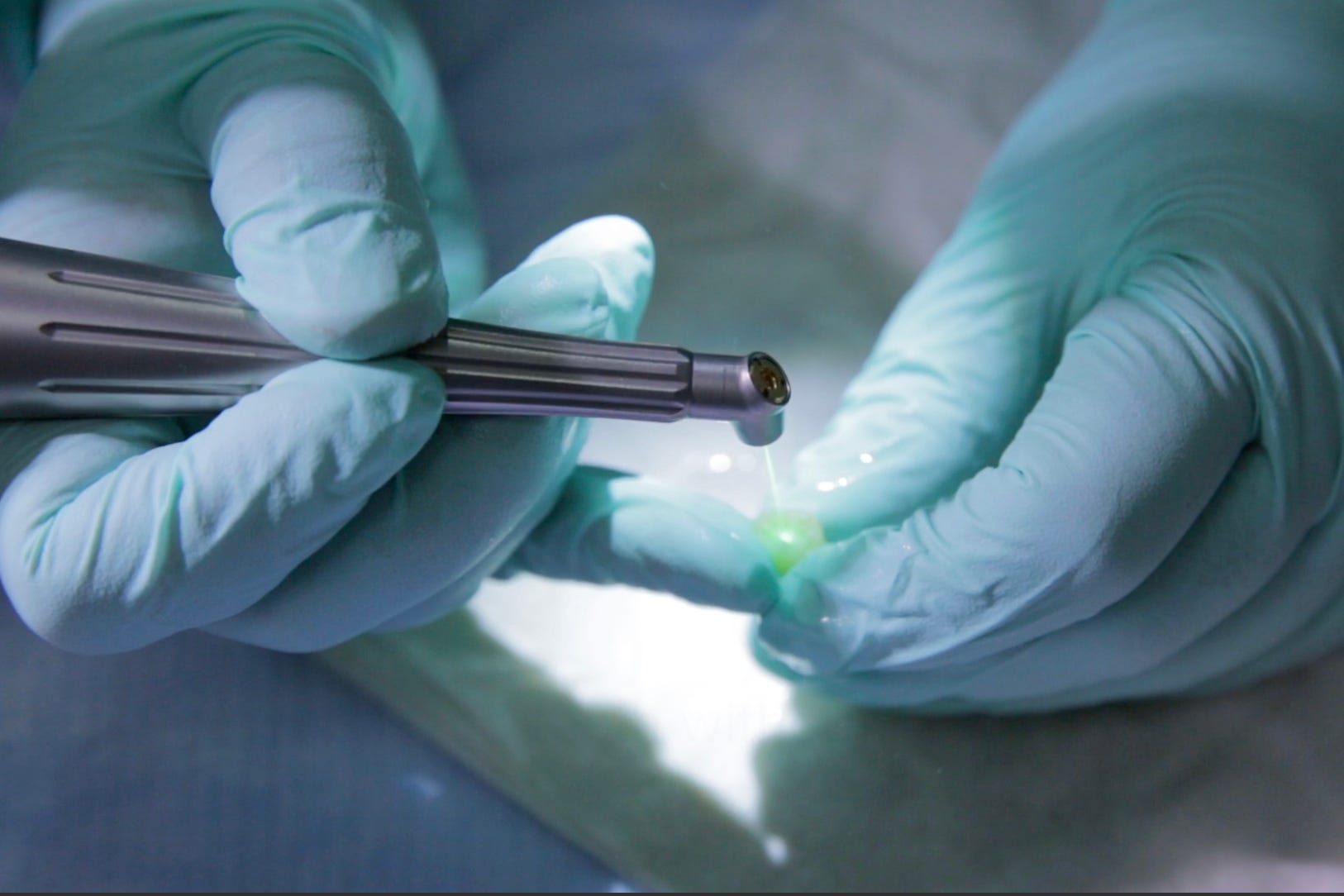 The End of Cavities? Lasers Can Now ReEngineer Teeth to Make Them Stronger