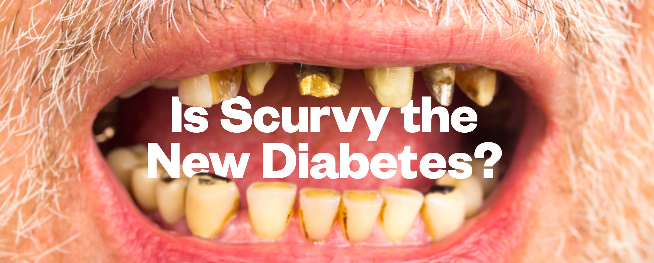 is-scurvy-the-new-diabetes-matter-medium