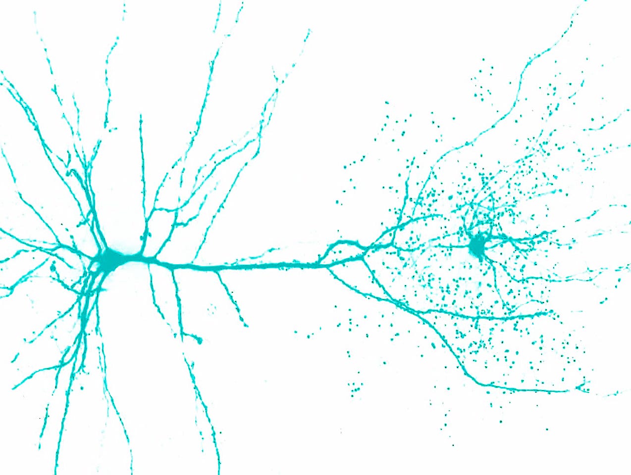 Fig.1A source: [https://www.forbes.com/sites/andreamorris/2018/08/27/scientists-discover-a-new-type-of-brain-cell-in-humans/](https://www.forbes.com/sites/andreamorris/2018/08/27/scientists-discover-a-new-type-of-brain-cell-in-humans/) — modified by myself