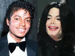 Body Dysmorphic Disorder Michael Jackson