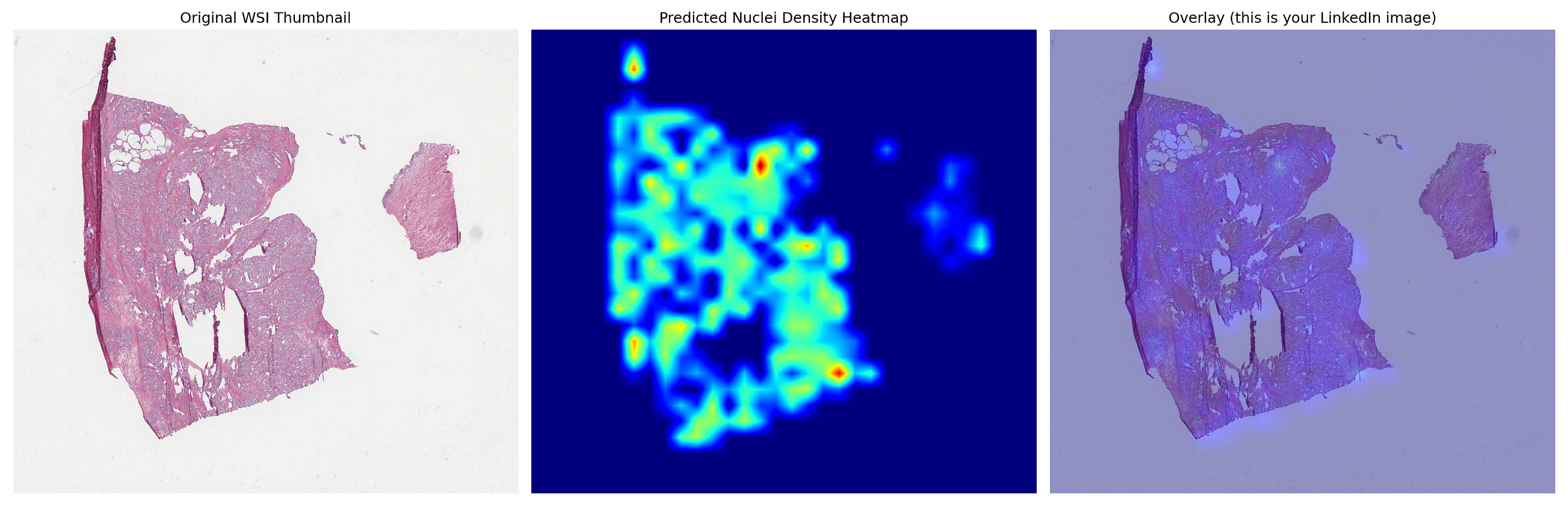 Beyond the Benchmark: Scaling Nuclei Segmentation to Real Gigapixel Pathology Slides