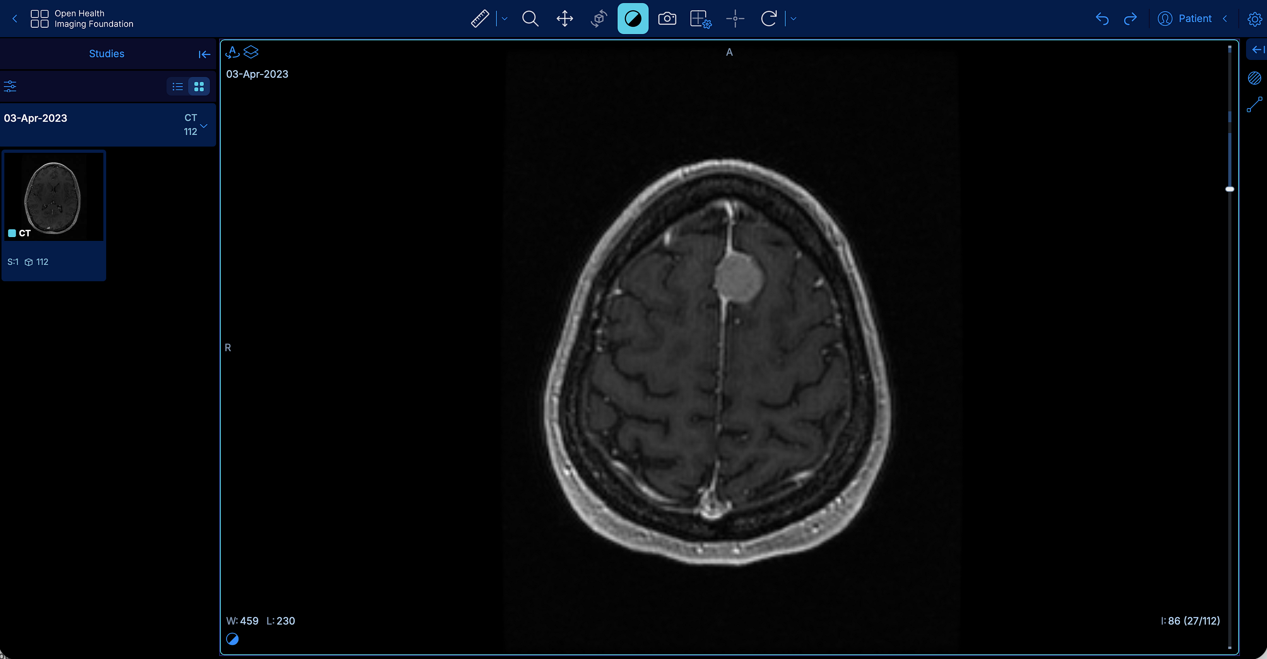 A CT scan in your browser? how web technology is changing medical imaging