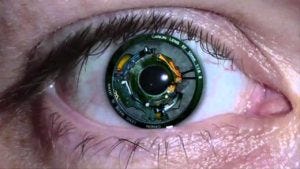 Could the lens of the future be a camera or even a laser