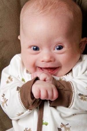 down-syndrome-baby-boy[1]