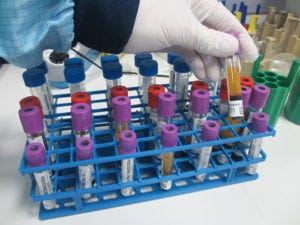 Human tissue samples