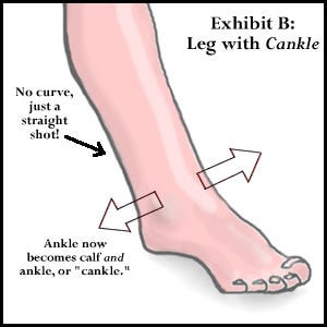 Cankles vs Normal Ankles. #SwollenAnkleDiversity, #CanklesNormalAnkles,