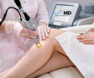 best hair removal services