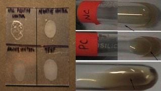 A-Slide Coagulase reaction of S. aureus, BTube Coagulase reaction of S. aureus.