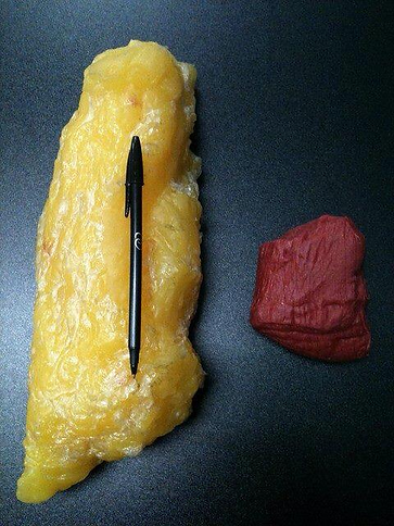 1 Pound of Muscle VS 1 Pound of Fat