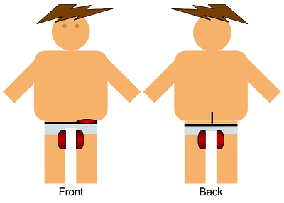Boxer Jock Discomfort diagram