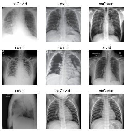 Uso de radiografías para detectar el COVID