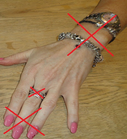 Hand with nail polish, rings, bracelets and watches accompanied by red crosses