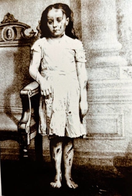 Photo of Mary Ellen Wilson, circa 1874