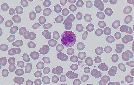Eosinophils -“Stormchasers of the Immune System”