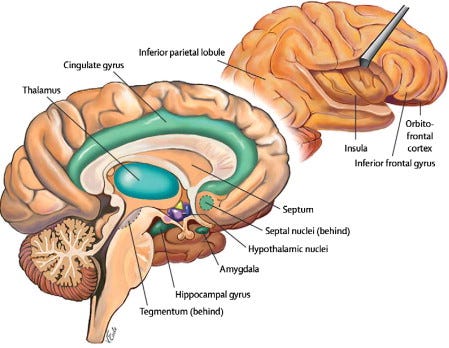 sexual-attraction-brain