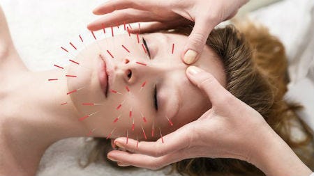 Get Acupuncture Treatment For Anxiety And Depression