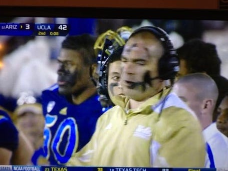 UCLA Coach Eye Black